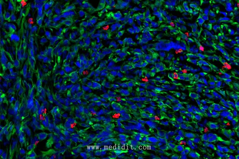 肿瘤的免疫荧光图像