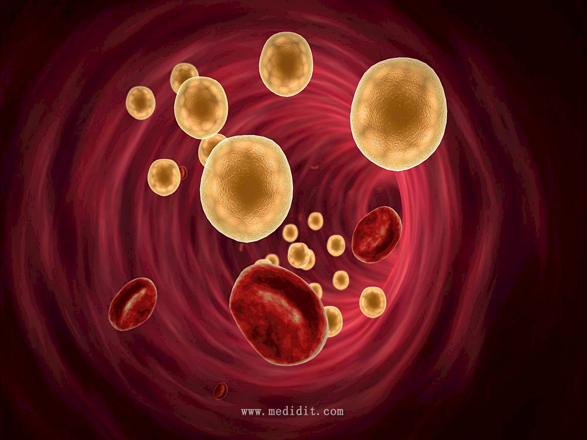 血脂细胞